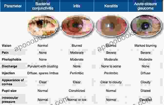 Examination And Interpretation: A Comprehensive Guide To Diagnosing Eye Conditions Visual Fields: Examination And Interpretation (American Academy Of Ophthalmology Monograph 3)