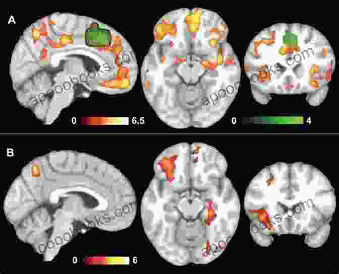 Image Of A Person With Psychopathy Interacting With A Therapy Dog, Showing Increased Neural Connectivity Between The Amygdala And Prefrontal Cortex A Neurological Study On The Effects Of Canine Appeal On Psychopathy Or RIO ADOPTS A PUPPY: A Cas Russell Short Story (Cas Russell Series)