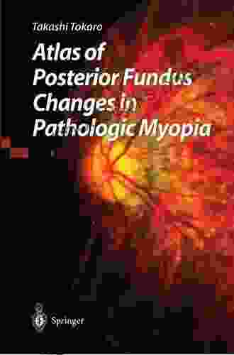 Atlas Of Posterior Fundus Changes In Pathologic Myopia
