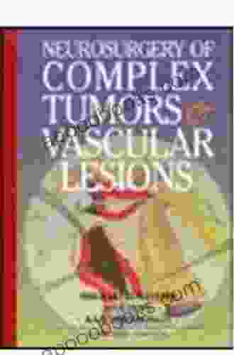Neurosurgery Of Complex Vascular Lesions And Tumors